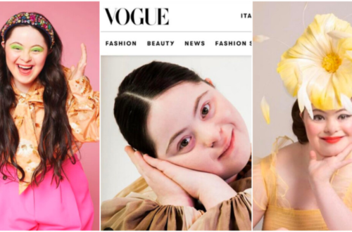 Woman With Down’s Who Was Given 0 Prospects At Birth Now Models For Gucci And Vogue